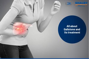 All about Gallstone and its Treatment  – Shalby Hospital